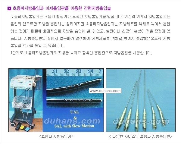[두한성형외과 경쟁력 간편지방흡입] - [복부(뱃살) 비만 간편지방흡입] 관련 이미지 5