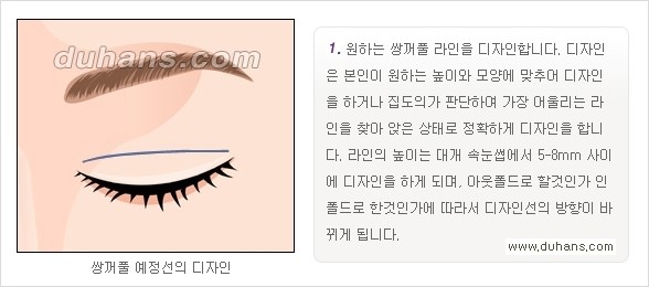 ​[두한성형외과 경쟁력 눈성형] - [자연스럽고 아름다운 쌍꺼풀의 기준] 관련 이미지 7
