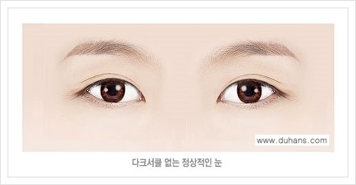 [두한성형외과 경쟁력 다크써클 교정] - [다크써클 5단계로 이뤄지는 핵심 5 STEP SOLUTION 안내 1.] 관련 이미지 1