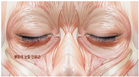 [두한성형외과 눈밑성형] - [다크서클 치료 실패] 관련 이미지 2