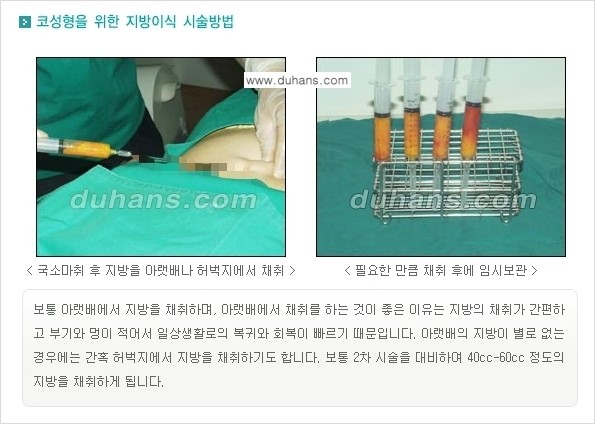 [두한성형외과 경쟁력 미세지방이식] - [코 지방이식 1.] 관련 이미지 6