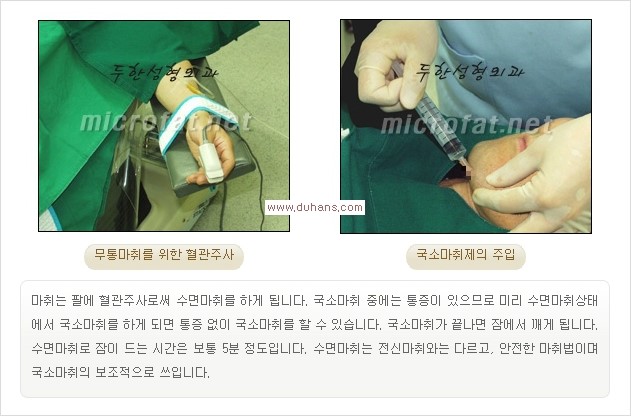 [두한성형외과 경쟁력 미세지방이식] - [타병원에서의 미세지방이식 이후 부작용 교정의 대상 안내] 관련 이미지 13