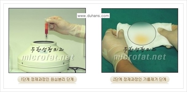 [두한성형외과 경쟁력 미세지방이식] - [두한 미세지방이식 클리닉의 특징 안내] 관련 이미지 9