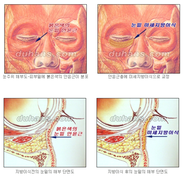 눈밑 다크써클 개선 원리 관련 이미지 4