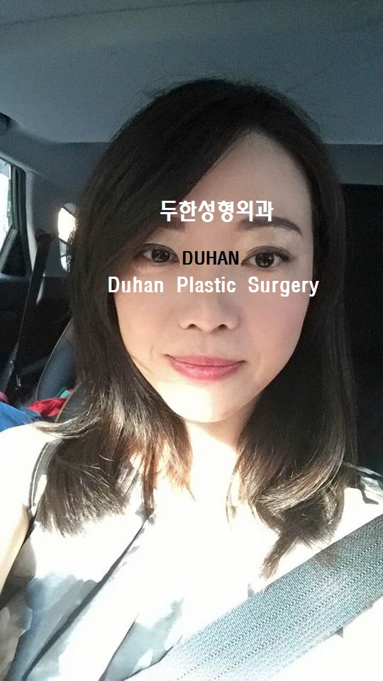 #극한눈재수술  #쌍꺼풀재수술 #눈수술입니다. #외반교정 #안검퇴축 관련 이미지 3