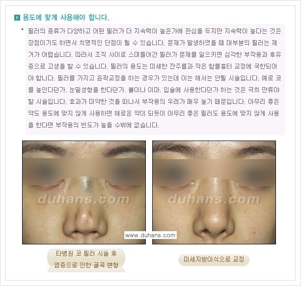 [두한성형외과 경쟁력 주름성형] - [필러 사용에 대한 주의점 안내] 관련 이미지 1