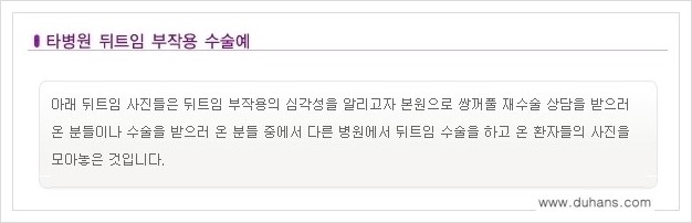 [두한성형외과 경쟁력 있는 쌍꺼풀 재수술] - [뒤트임 수술] 관련 이미지 2