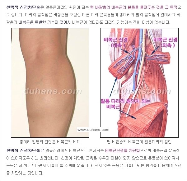 ​[두한성형외과 날씬한 종아리 만들기!] - [간편하고 안전한 종아리 축소방법 ①] 관련 이미지 7