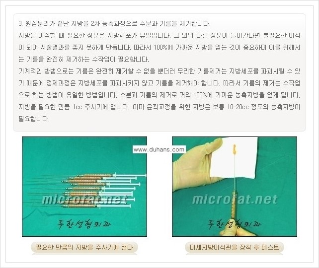 [두한성형외과 경쟁력 미세지방이식] - [부드럽고 아름다운 얼굴 윤곽선 이마(전두부) 미세지방이식] 관련 이미지 6