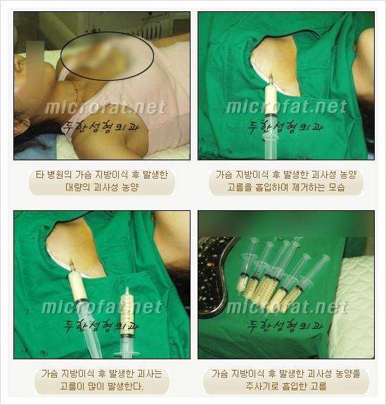 [두한성형외과 경쟁력 지방이식] - [두한 자가지방이식 클리닉 안내]​ 관련 이미지 53