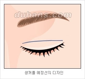 [두한성형외과 경쟁력 눈성형 리더] - [아름다운 눈매를 위한 쌍꺼풀 수술 안내] 관련 이미지 2