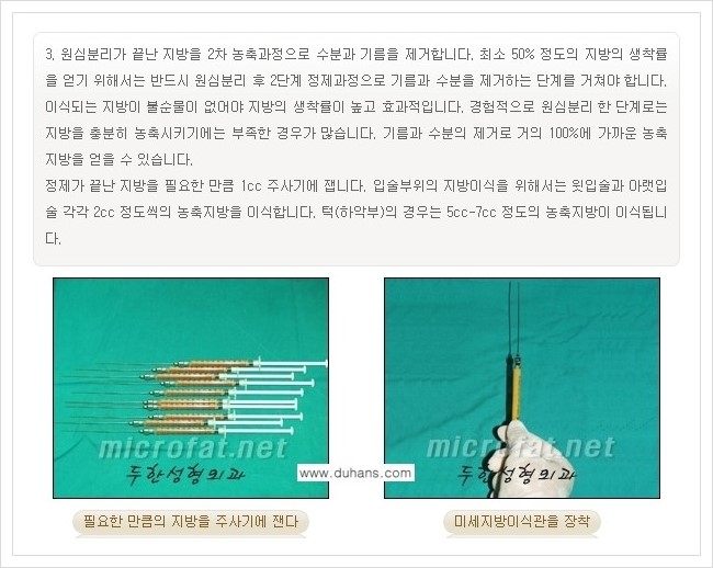 ⁠⁠[두한성형외과 경쟁력 미세지방이식] - [턱 미세지방이식 - 안면윤곽 교정 안내] 관련 이미지 9