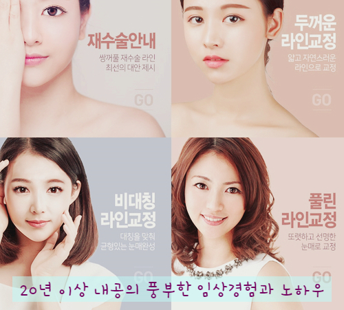 Candidates for Double Eyelid Revision Surgery: Unattractive Double Eyelids, Beautiful Double Eyelids image 43