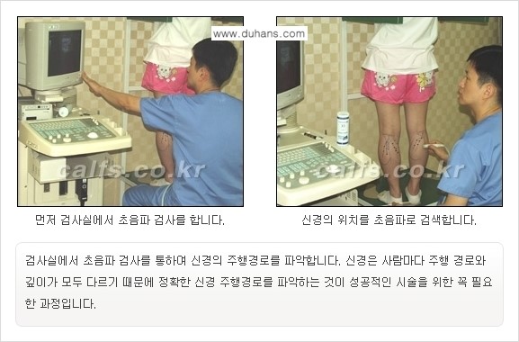 ​[두한성형외과와 날씬한 종아리 만들기!] - [간편하고 안전한 종아리 축소방법 ②] 관련 이미지 6