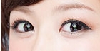 [Dohan Plastic Surgery Double Eyelid Surgery] - [Beautiful Double Eyelids] image 6