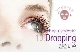[Duhan Plastic Surgery Double Eyelid Revision] - [Thick Double Eyelid Line] image 72