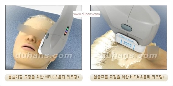 [두한성형외과 경쟁력 주름성형] - [간단하면서 자연스러운 주름제거 방법] 관련 이미지 12