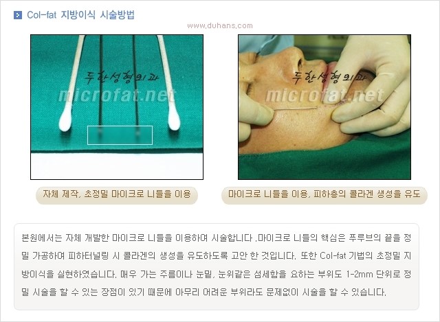 [두한성형외과 경쟁력 눈밑성형] - [다크써클 증상과 증상에 맞는 치료 방법] 관련 이미지 45