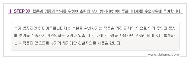 [두한성형외과 경쟁력 쌍꺼풀 재수술, 극한 재수술] - [쌍꺼풀 재수술의 과정 안내 1.] 관련 이미지 9