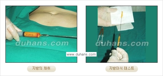 ⁠⁠[두한성형외과 경쟁력 미세지방이식] - [3차원 입체지방이식, 2차원 평면지방이식] 관련 이미지 1
