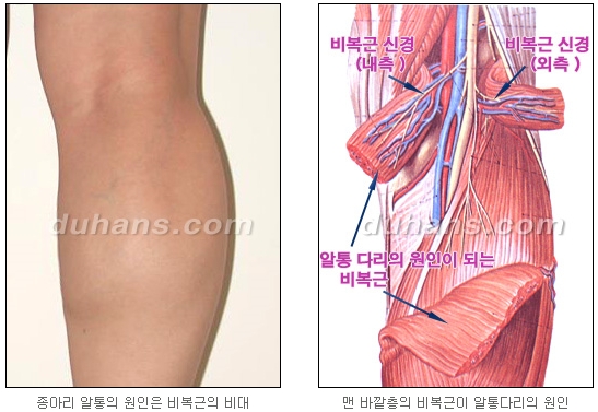 [Duhan Plastic Surgery Calf Reduction] - [How to Get Rid of Calf Muscle Bulges] image 6