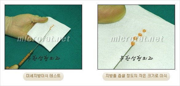 [두한성형외과 경쟁력 지방이식] - [두한 자가지방이식 클리닉 안내]​ 관련 이미지 27