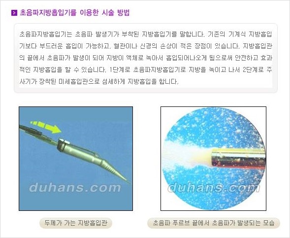 [두한성형외과 경쟁력 얼굴 미세지방흡입] - [볼살, 턱선 지방흡입 안내] 관련 이미지 3