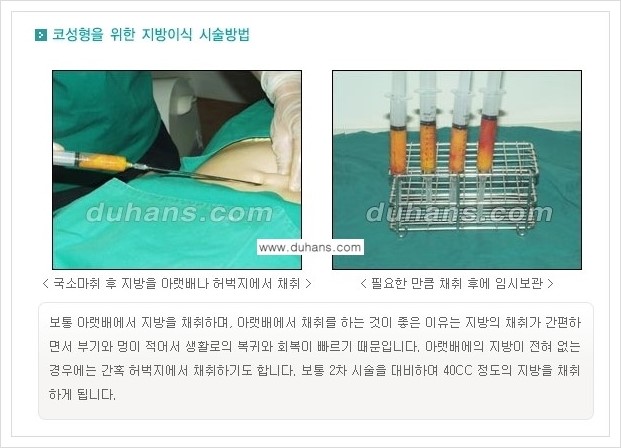[두한성형외과 경쟁력 미세지방이식] - [자연스러운 코높임 지방이식 안내 ①] 관련 이미지 6