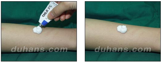 [Duhan Plastic Surgery Double Eyelid Surgery] - [Types of Double Eyelid Surgery] image 46