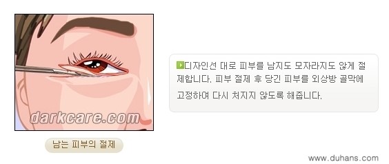 ​[두한성형외과 NO.1 다크써클 교정] - [하안검 성형술 + 눈밑지방 재배치] 관련 이미지 8