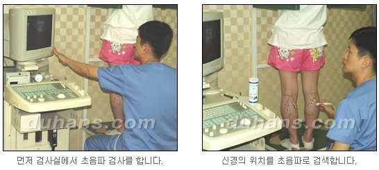 [두한성형외과 종아리축소술] - [초음파 유도 선택적 신경차단술 안내] 관련 이미지 7