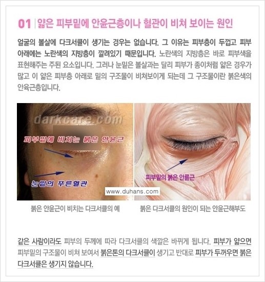 [두한성형외과 경쟁력 다크써클 교정] - [다크써클의 원인 안내] 관련 이미지 2