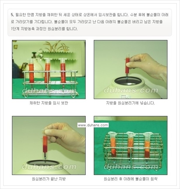[두한성형외과 경쟁력 미세지방이식] - [부드럽고 아름다운 얼굴선 만들기, 얼굴 미세지방이식 과정 안내] 관련 이미지 4