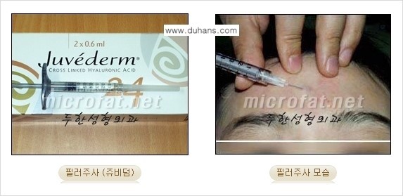 [두한성형외과 경쟁력 Quick 주름성형] - [주름교정을 위한 간편한 필러시술] 관련 이미지 1