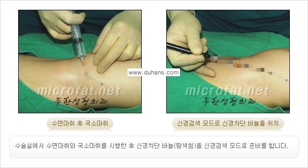 [두한성형외과 경쟁력 멀티종아리성형] - [초음파 유도 비절개 선택적 신경차단술의 효과] 관련 이미지 11