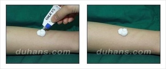 [두한성형외과 안전성형 우선주의] - [성형 통증을 최소화하는 수면마취, 무통마취 안내] 관련 이미지 5