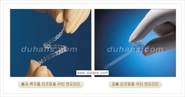 [두한성형외과 경쟁력 주름성형] - [엔도타인 리프팅 안내 ①] 관련 이미지 4