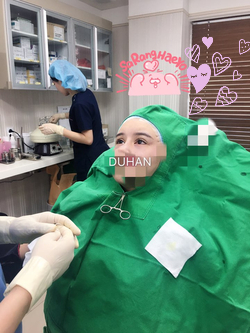 [Duhan Plastic Surgery Double Eyelid Surgery] - [Types of Double Eyelid Surgery] image 1