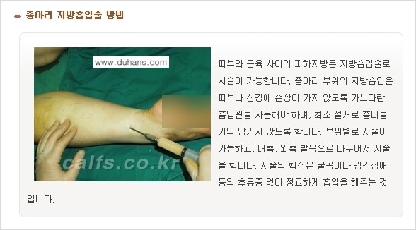 [두한성형외과 날씬한 종아리 만들기!] - [종아리 성형 안내 2.] 관련 이미지 4