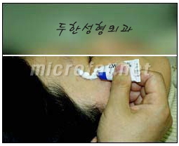[Duhan Plastic Surgery Wrinkle Improvement] - [Wrinkle Filler Procedure] image 3