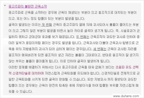 [두한성형외과 경쟁력 멀티종아리성형] - [초음파 유도 비절개 선택적 신경차단술의 효과] 관련 이미지 22