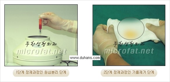 [두한성형외과 경쟁력 미세지방이식] - [Dr. 컬럼 "미세지방이식 클리닉의 특징과 자부심"] 관련 이미지 4