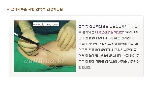 [두한성형외과 경쟁력 멀티종아리성형] - [나에게 맞는 종아리성형 방법의 종류 안내 1.] 관련 이미지 4