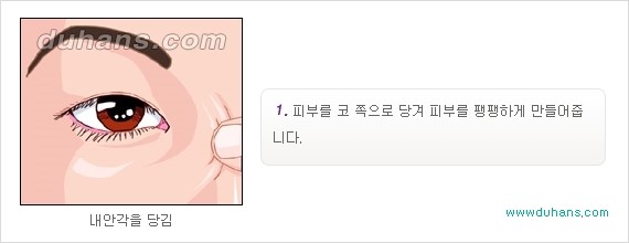 [두한성형외과 경쟁력 눈성형] - [몽고주름 제거수술, 앞트임 수술 안내] 관련 이미지 7