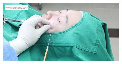 [두한성형외과 경쟁력 멀티성형] - [다크써클 + 인디언밴드 콤비 프로그램 안내] 관련 이미지 9