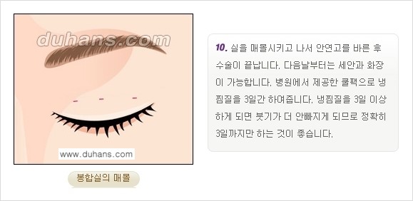 [두한성형외과 경쟁력 눈성형] - [쌍꺼풀 재수술 방법 - 부분절개법(Partial incision method) 과정 안내] 관련 이미지 11