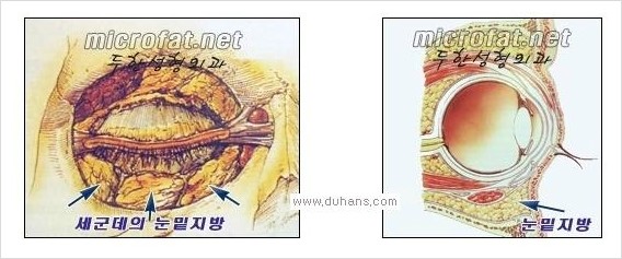 [두한성형외과 경쟁력 안검성형] - [젊은 눈매 안검성형의 여러 가지 방법 안내] 관련 이미지 109