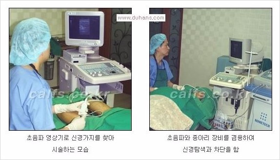 [두한성형외과 Dr. 컬럼 - 타 병원의 종아리 퇴축술 이후 문제가 발생한 경우] 관련 이미지 8