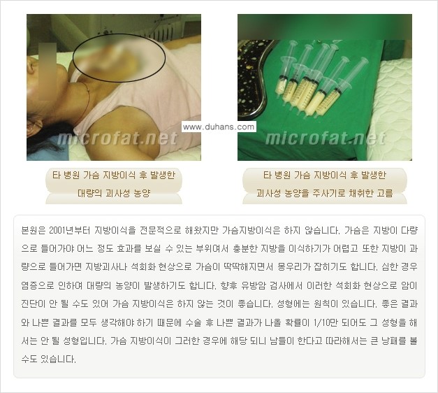 [두한성형외과 "미세지방이식"] - [지방이식 부작용 교정 정보 ①] 관련 이미지 12