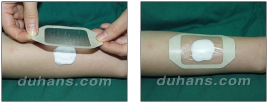 [Duhan Plastic Surgery Double Eyelid Surgery] - [Types of Double Eyelid Surgery] image 47
